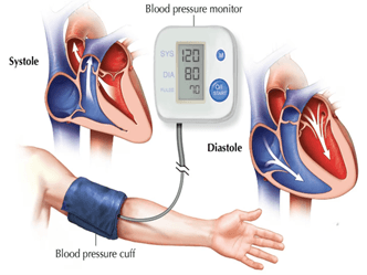 Picture3 | roma hospital Medical illustration of blood pressure measurement on the left arm with cuff and a digital monitor showing 120/80 (systolic/diastolic).