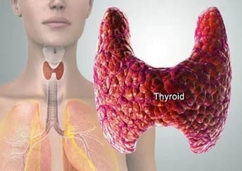 Picture4 | roma hospital Medical illustration of the neck showing the thyroid gland highlighted next to a simplified anatomical model of the neck and endocrine system