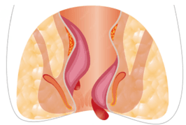 Picture5 | roma hospital Medical illustration of the neck showing the thyroid gland highlighted next to a simplified anatomical model of the neck and endocrine system