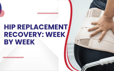 Hip replacement recovery: Week by week