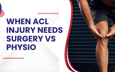 When ACL injury needs surgery vs physio