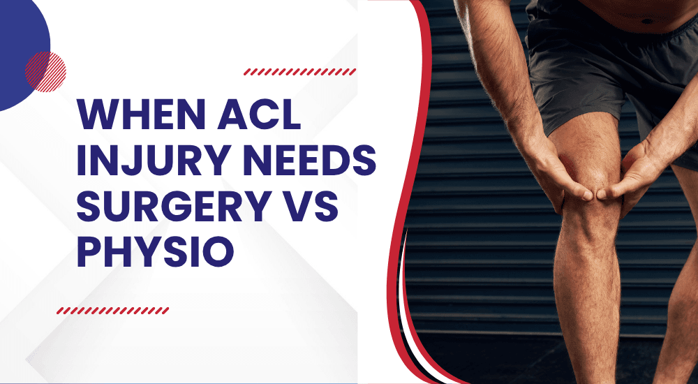 When ACL injury needs surgery vs physio