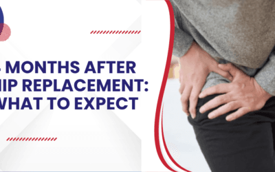4 Months After Hip Replacement: What’s Normal and What’s Next