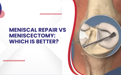 Meniscal repair vs meniscectomy: Which is better?