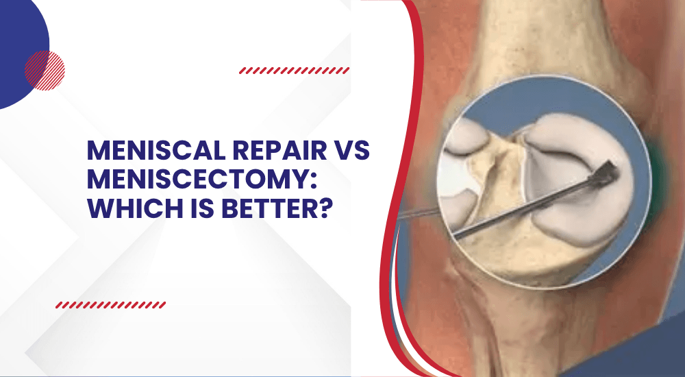 Meniscal repair