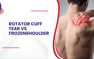 Rotator cuff tear vs frozen shoulder
