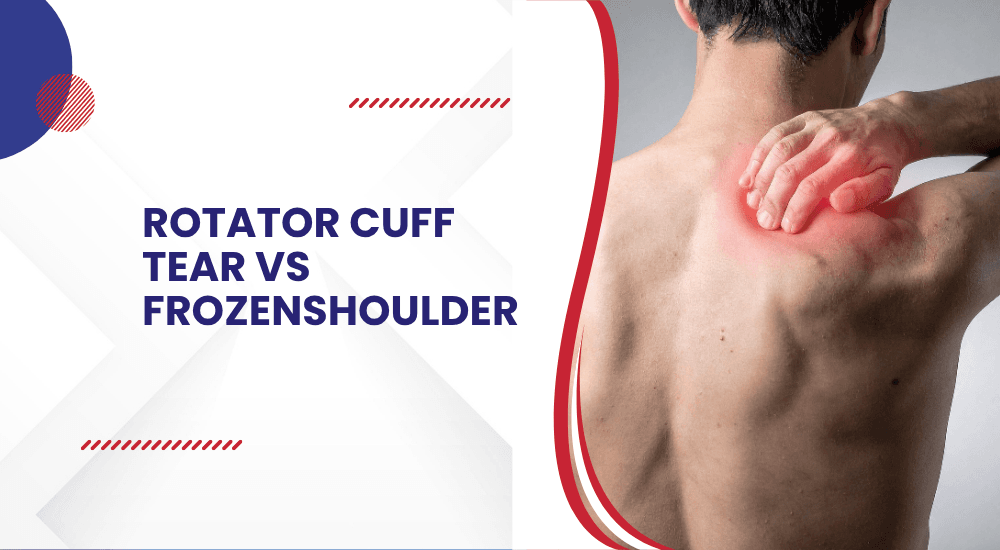 Rotator cuff tear